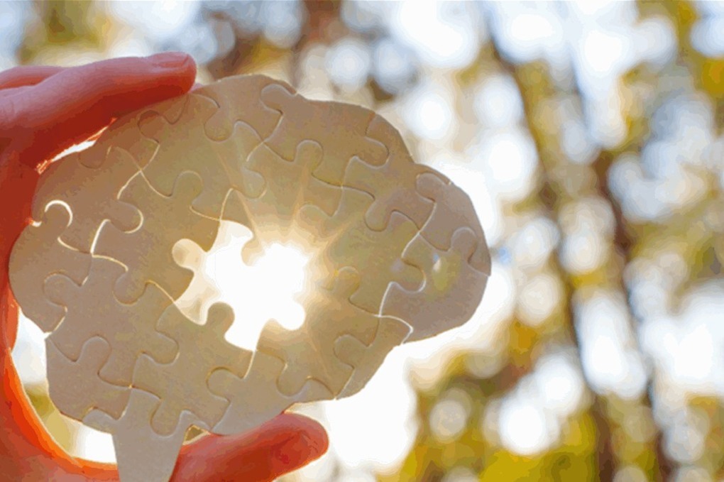 لماذا تضعف ذاكرتنا مع التقدم في العمر؟ 