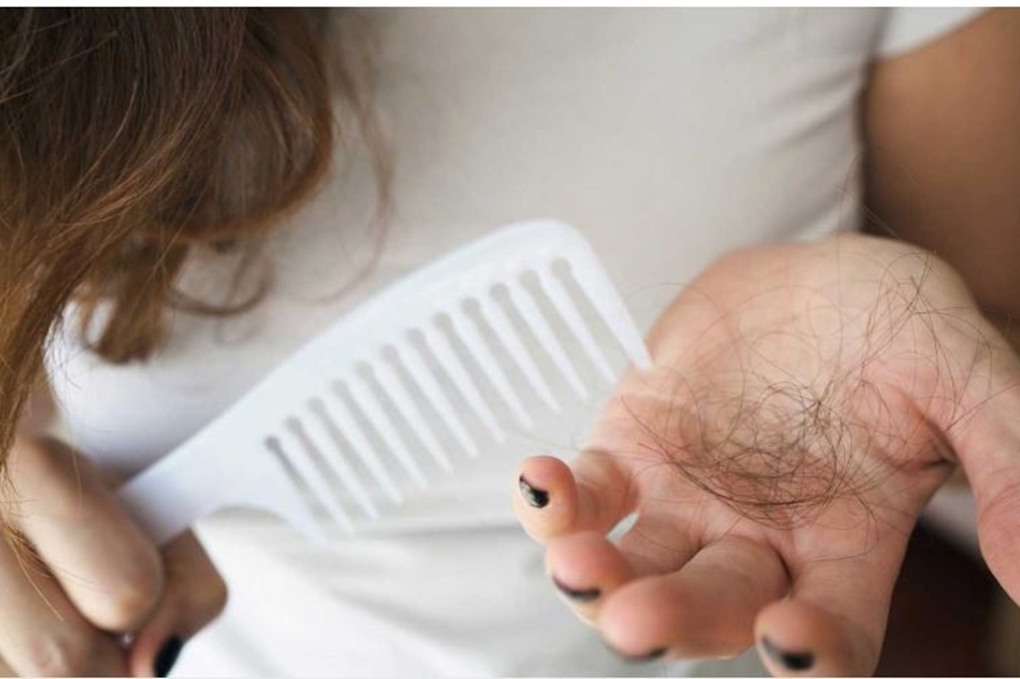 الفيتامينات الأساسية لتعزيز صحة الشعر ومنع التساقط 