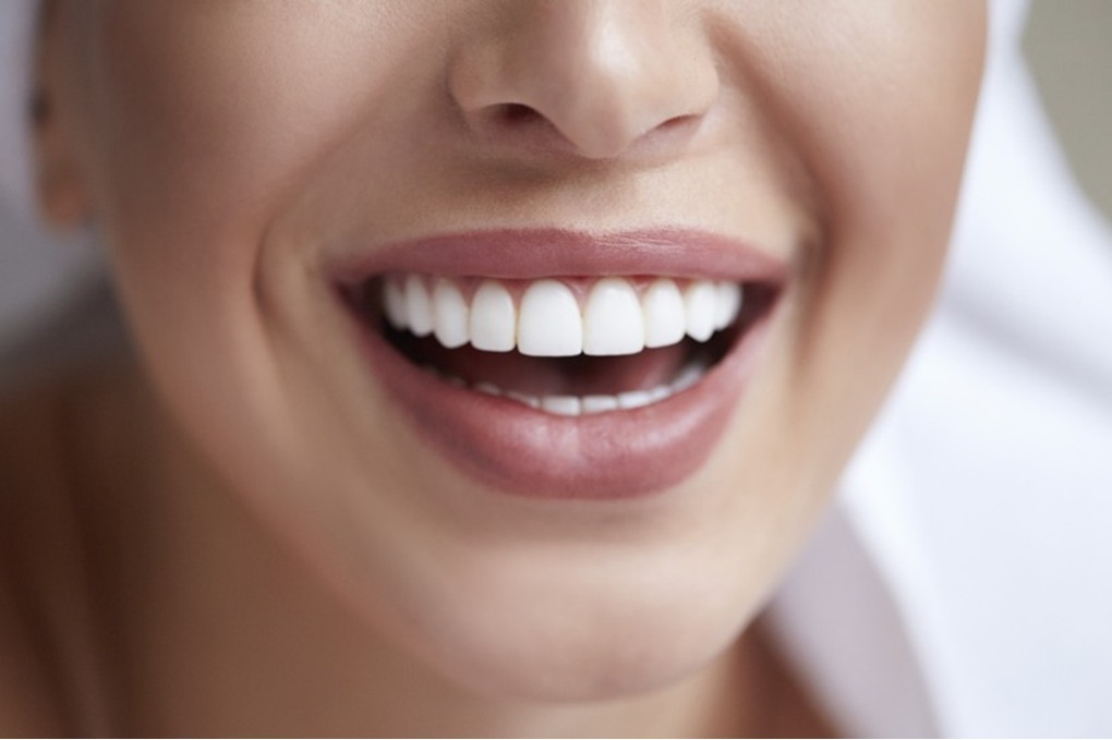 أطعمة بسيطة تعزز بياض الأسنان طبيعيا 